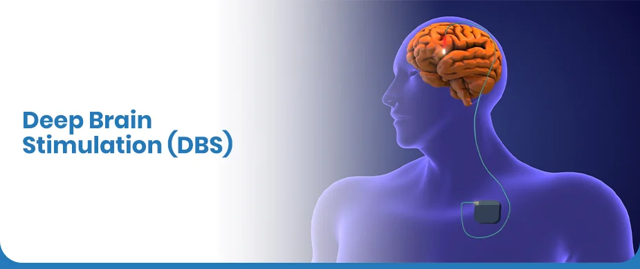 Deep Brain Stimulation Surgery Hospital – DBS Cost